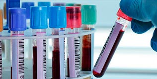 Exames Complementares